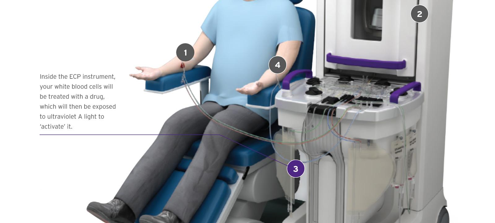 Label 3 of the diagram points to the tubing and components near the base of the instrument. Inside the ECP instrument, your white blood cells will be treated with a drug, which will then be exposed to ultraviolet A light to 'activate' it.